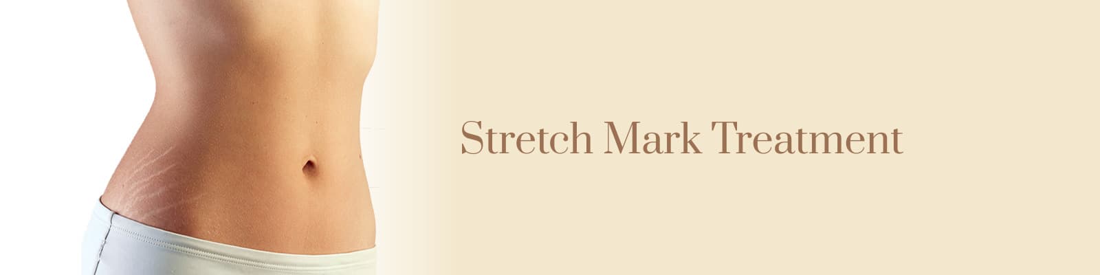 Stretch Marks Treatment in Delhi