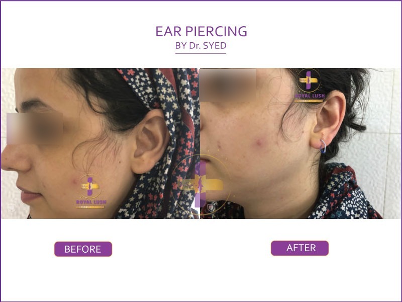 ear piercing in south delhi