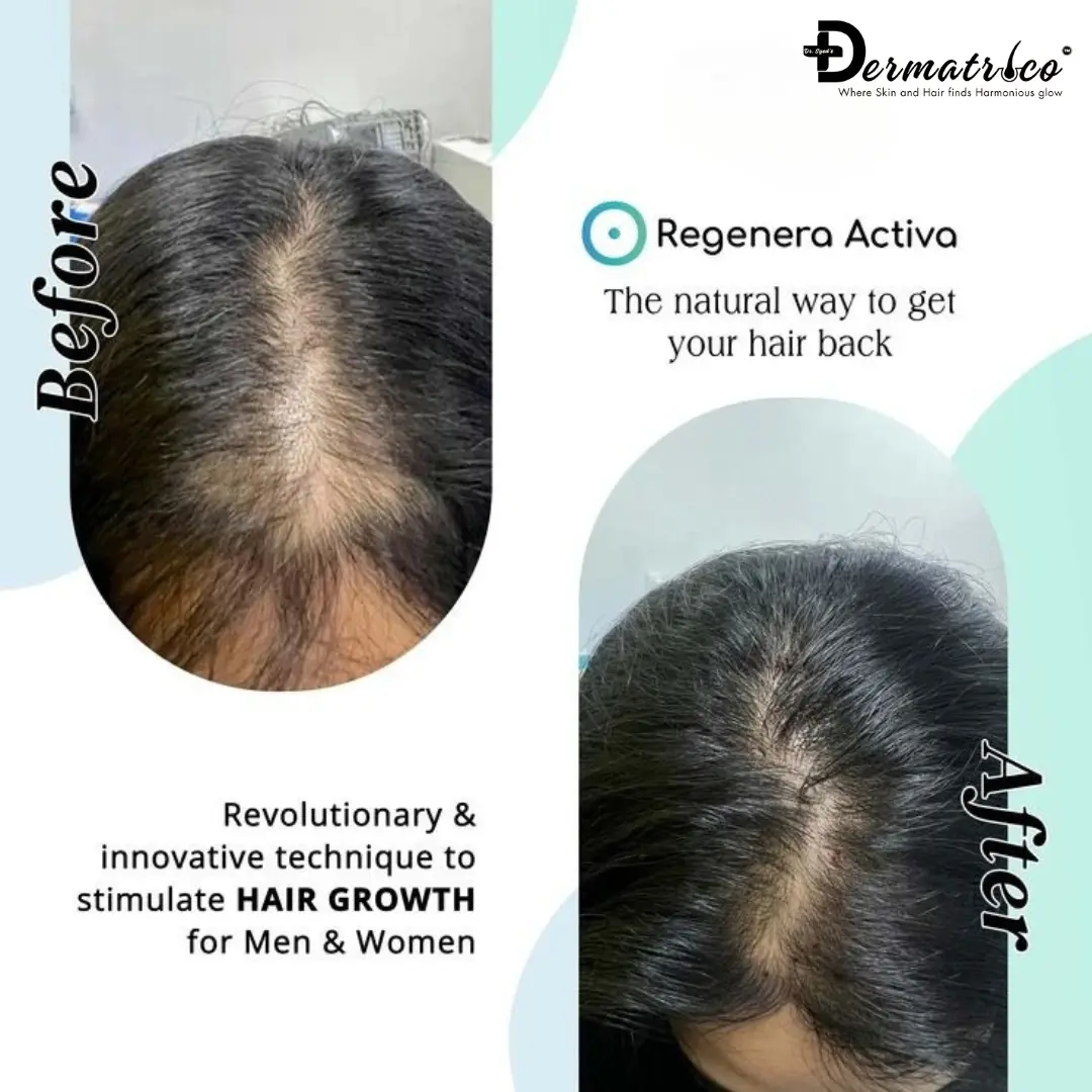 regenera-activa