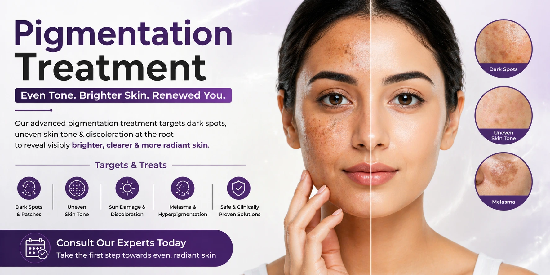 pigmentation-treatment-in-delhi