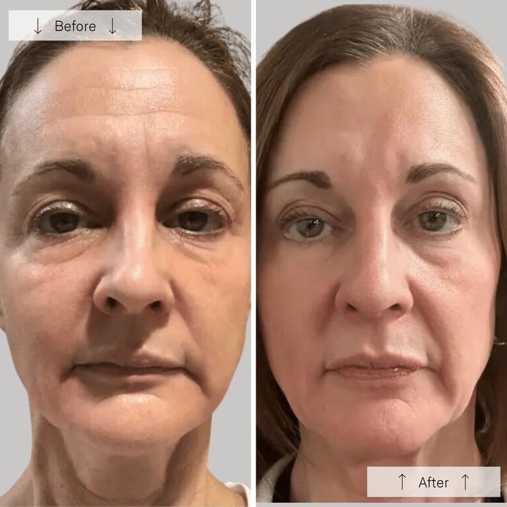  Anti Ageing Best Skin Clinic near Panchsheel Park – Trusted Skin Specialist & Dermatologist
